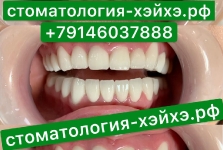 Пример лечения зубов_1