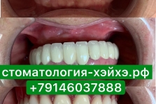 Стоматология в Китае 2019_3