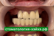 Стоматология в Китае 2019 ноябрь_2
