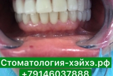 Стоматология в Китае, г. Хэйхэ_11