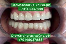 Стоматология в Китае, г. Хэйхэ_1