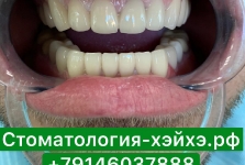 Стоматология в Китае, г. Хэйхэ_30