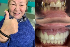 Стоматология в Китае, г. Хэйхэ_35